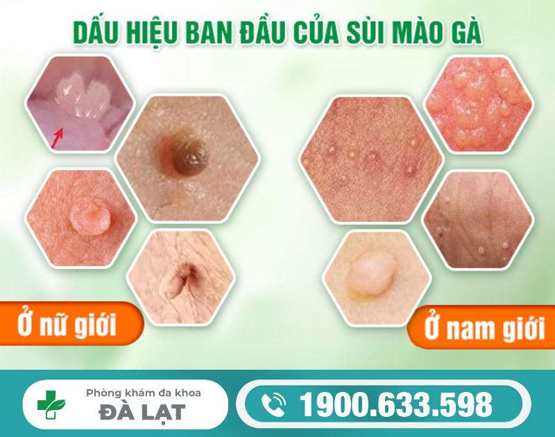 Hình ảnh minh họa